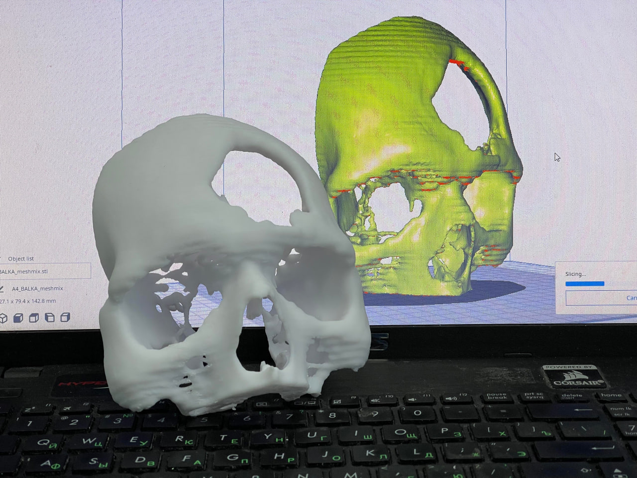 Врачи Центра травматологии поделились опытом применения 3D-технологий