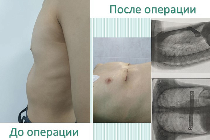 В кировском Центре травматологии применяют уникальный метод обезболивания