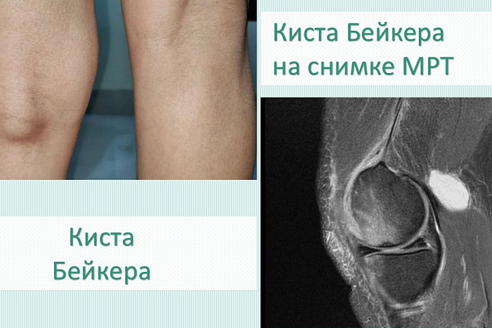 В Кирове развивается «хирургия одного дня»